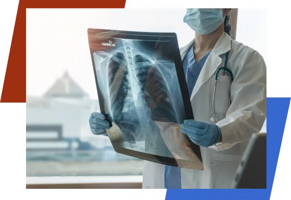 Doctor holding lung X-ray
